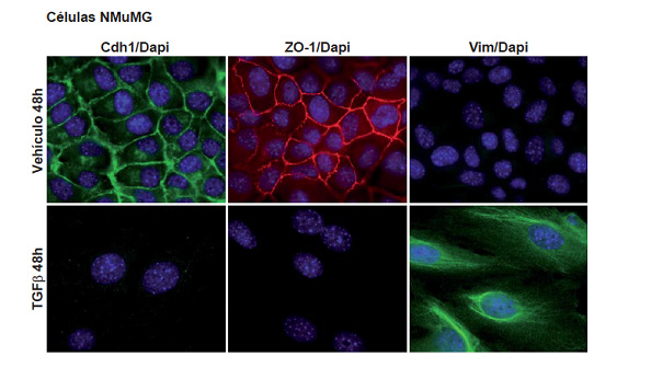 Figura 3. Transición de epitelio a mesénquima en células NMuMG inducida por TGF-beta. E-Cadherin (Cdh1) (verde); ZO-1 (rojo); Vimentina (Vim) (verde) DAPI (azul)