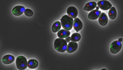 Un estudio del CSIC explica un nuevo mecanismo para enteneder el envejecimiento prematuro de las células madre